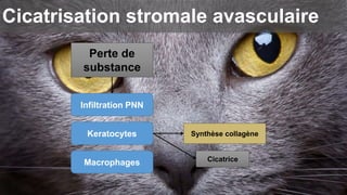 Cicatrisation stromale avasculaire 
Perte de 
substance 
Infiltration PNN 
Keratocytes 
Macrophages 
Synthèse collagène 
Cicatrice 
 