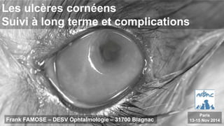 Les ulcères cornéens 
Suivi à long terme et complications 
Frank FAMOSE – DESV Ophtalmologie – 31700 Blagnac 
Paris 
13-15 Nov 2014 
 