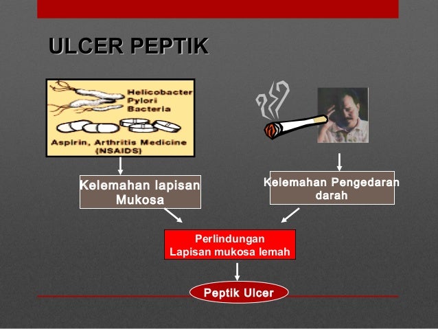 ULCER PEPTIK