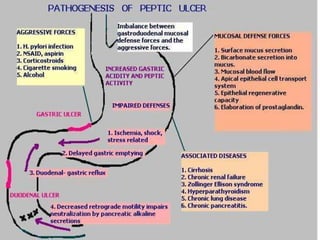 Ulcer ppt