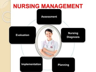 NURSING MANAGEMENT
Assessment
Nursing
Diagnosis
Planning
Implementation
Evaluation
 