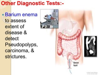 Other Diagnostic Tests:-
 Barium enema
to assess
extent of
disease &
detect
Pseudopolyps,
carcinoma, &
strictures.
 