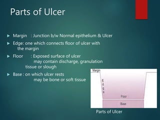 Parts of Ulcer
 Margin : Junction b/w Normal epithelium & Ulcer
 Edge: one which connects floor of ulcer with
the margin
 Floor : Exposed surface of ulcer
may contain discharge, granulation
tissue or slough
 Base : on which ulcer rests
may be bone or soft tissue
Parts of Ulcer
 