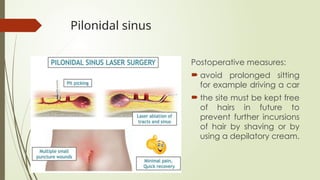 ULCER, SINUS, abscess, fistula vewry basics.pptx