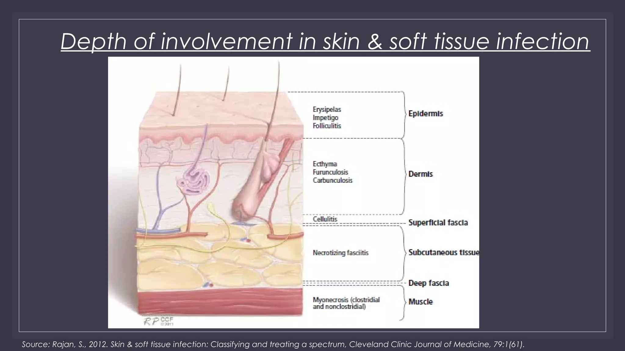 Ulcers & skin infections | PPT