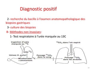 Diagnostic positif
2- recherche du bacille à l’examen anatomopathologique des
biopsies gastriques
3- culture des biopsies
B- Méthodes non invasives:
1- Test respiratoire à l’urée marquée au 13C
14
 