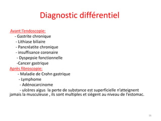 Diagnostic différentiel
Avant l’endoscopie:
- Gastrite chronique
- Lithiase biliaire
- Pancréatite chronique
- insuffisance coronaire
- Dyspepsie fonctionnelle
-Cancer gastrique
Après fibroscopie:
- Maladie de Crohn gastrique
- Lymphome
- Adénocarcinome
- ulcères aigus la perte de substance est superficielle n’atteignent
jamais la musculeuse , ils sont multiples et siègent au niveau de l’estomac.
16
 