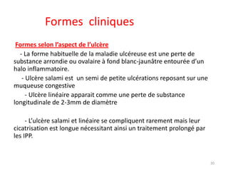 Formes cliniques
Formes selon l’aspect de l’ulcère
- La forme habituelle de la maladie ulcéreuse est une perte de
substance arrondie ou ovalaire à fond blanc-jaunâtre entourée d’un
halo inflammatoire.
- Ulcère salami est un semi de petite ulcérations reposant sur une
muqueuse congestive
- Ulcère linéaire apparait comme une perte de substance
longitudinale de 2-3mm de diamètre
- L’ulcère salami et linéaire se compliquent rarement mais leur
cicatrisation est longue nécessitant ainsi un traitement prolongé par
les IPP.
20
 