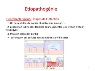 Etiopathogénie
Hélicobacter pylori : étapes de l’infection
1- Hp entrent dans l’estomac et s’attachent au mucus
2- production substances toxiques pour augmenter la sécrétion d’eau et
électrolytes
3- Invasion cellulaires par hp
4- destruction des cellules hautes et formation d’ulcères
6
 