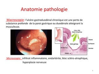 Anatomie pathologie
Macroscopie: l’ulcère gastroduodénal chronique est une perte de
substance profonde de la paroi gastrique ou duodénale atteignant la
musculeuse.
Microscopie: infiltrat inflammatoire, endartérite, bloc scléro-atrophique,
hyperplasie nerveuse
8
 