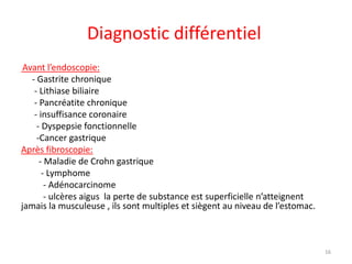 Diagnostic différentiel
Avant l’endoscopie:
- Gastrite chronique
- Lithiase biliaire
- Pancréatite chronique
- insuffisanc...