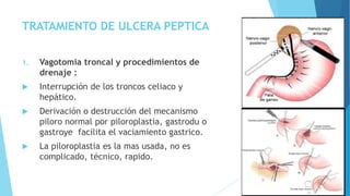 TRATAMIENTO DE ULCERA PEPTICA
3. Vagotomia troncal y seromiotomia
laparoscopica:
 Fácil de realizar, tiene la misma frecu...
