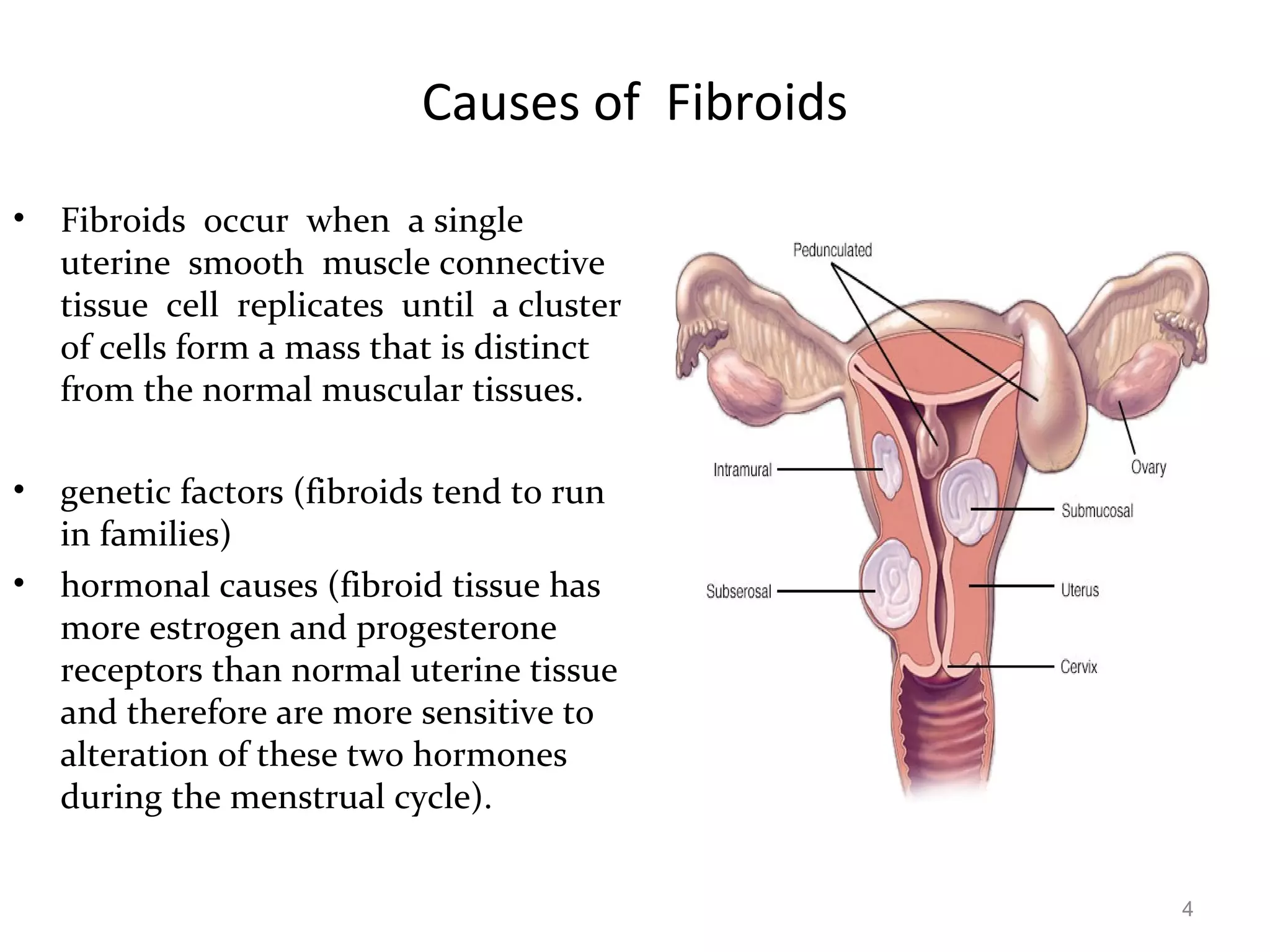 Medical Management of Fibroids | PPT