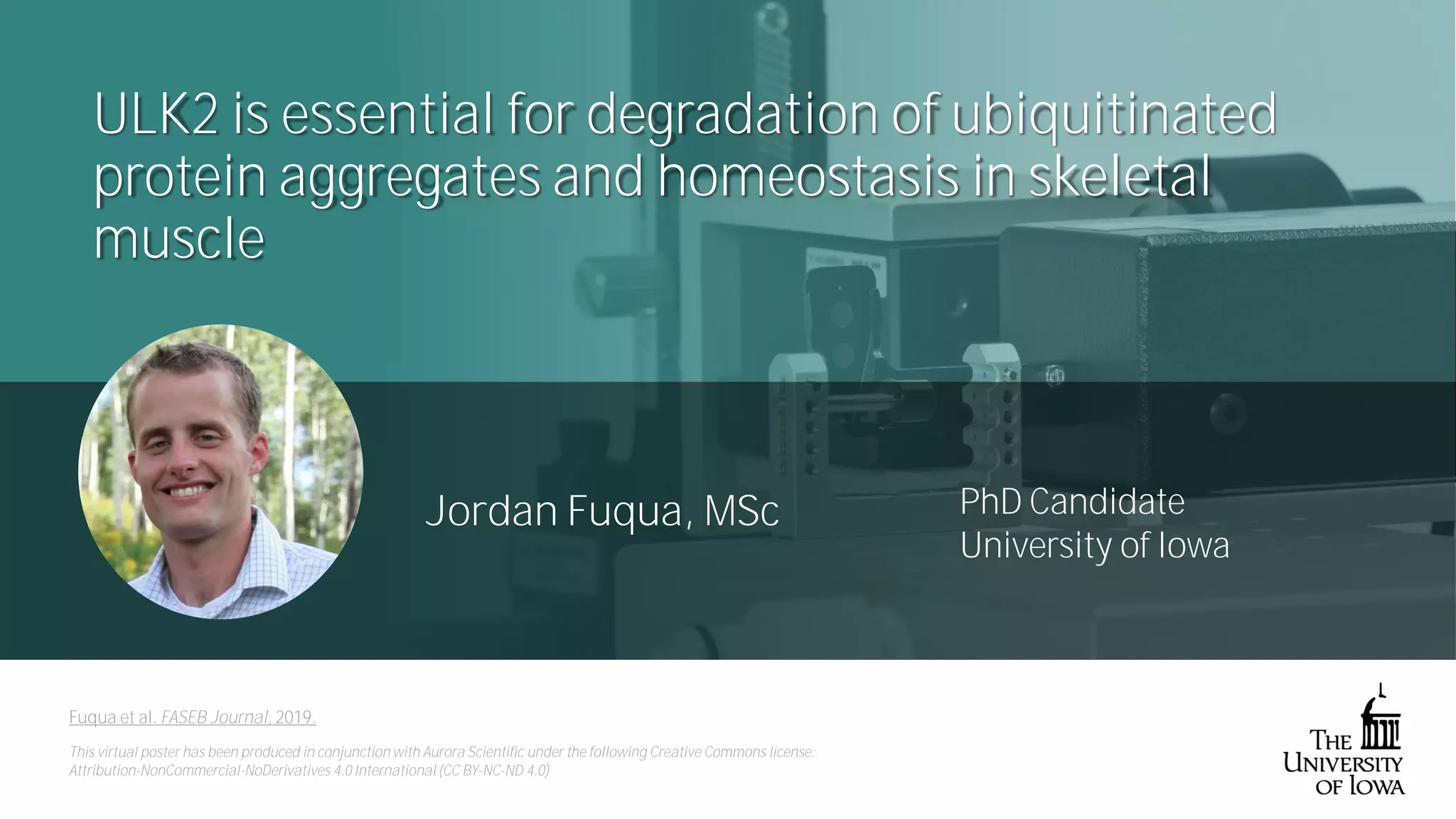 ULK2 is essential for degradation of ubiquitinated protein aggregates