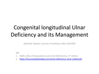 Congenital longitudinal Ulnar
Deficiency and its Management
Abhishek Tripathi, Lecturer, Prosthetics, NILD, KOLKATA
Ref:
1. AAOS, Atlas of Amputations and Limb Deficiencies, 3rd edition
2. https://musculoskeletalkey.com/ulnar-deficiency-ulnar-clubhand/
 