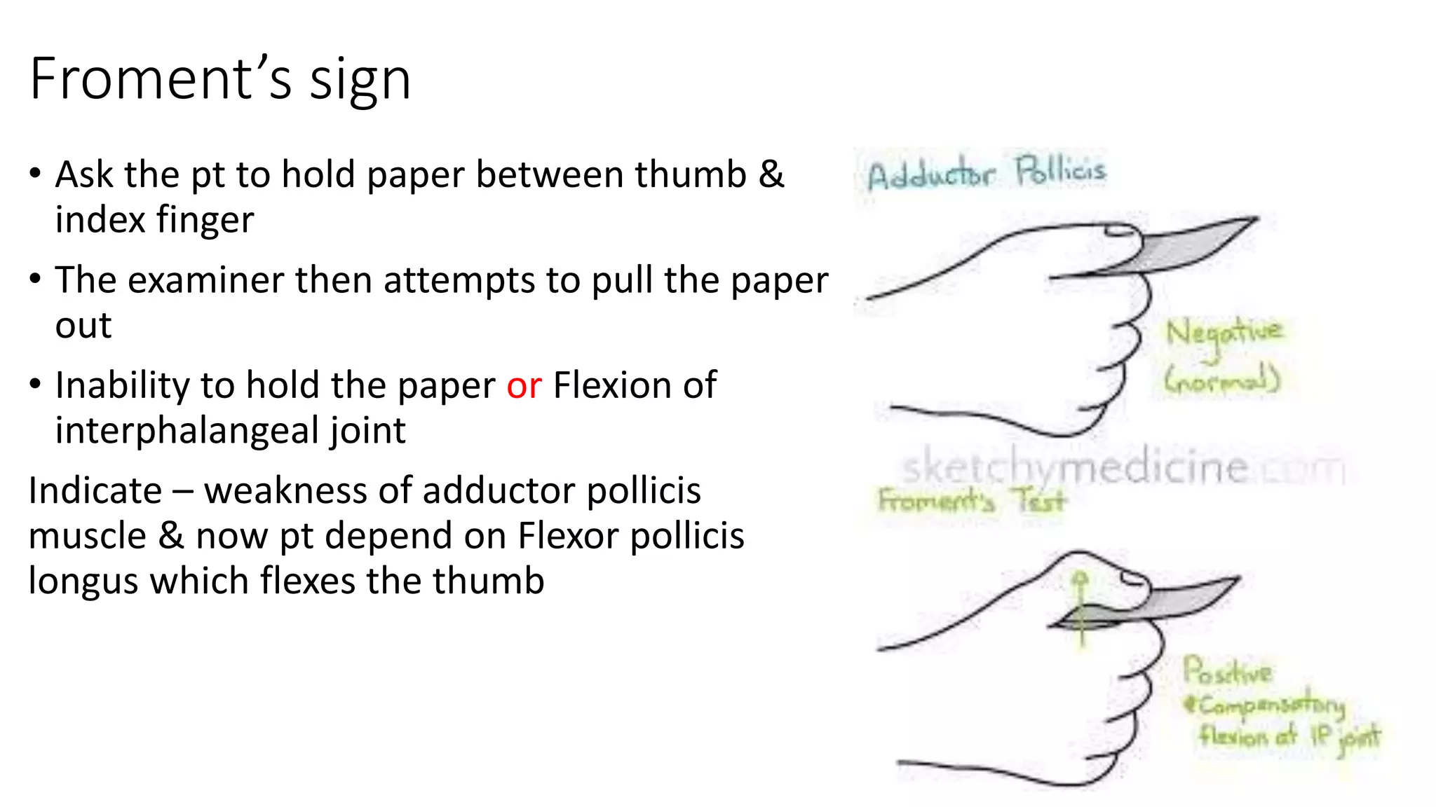 Ulnar nerve injury | PPTX