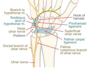 Dorsal Branch of Ulnar Nerve