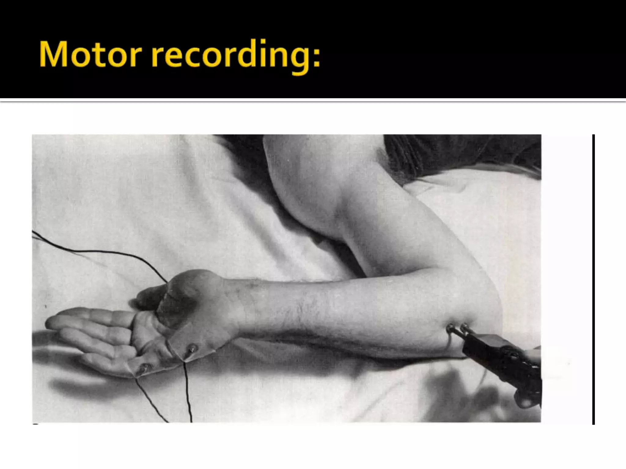 Ulnar nerve antomy and recording techniques