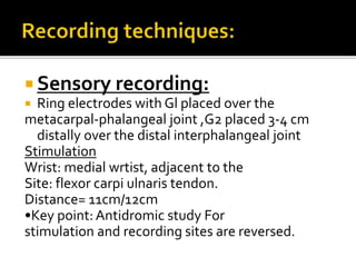  Sensory recording:
 Ring electrodes with Gl placed over the
metacarpal-phalangeal joint ,G2 placed 3-4 cm
distally over the distal interphalangeal joint
Stimulation
Wrist: medial wrtist, adjacent to the
Site: flexor carpi ulnaris tendon.
Distance= 11cm/12cm
•Key point:Antidromic study For
stimulation and recording sites are reversed.
 