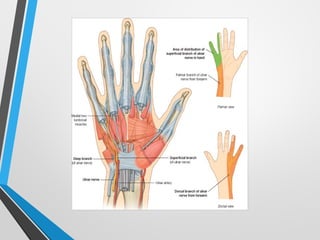 ulnar nerve palsy for first year Orthopaedic pg | PPTX