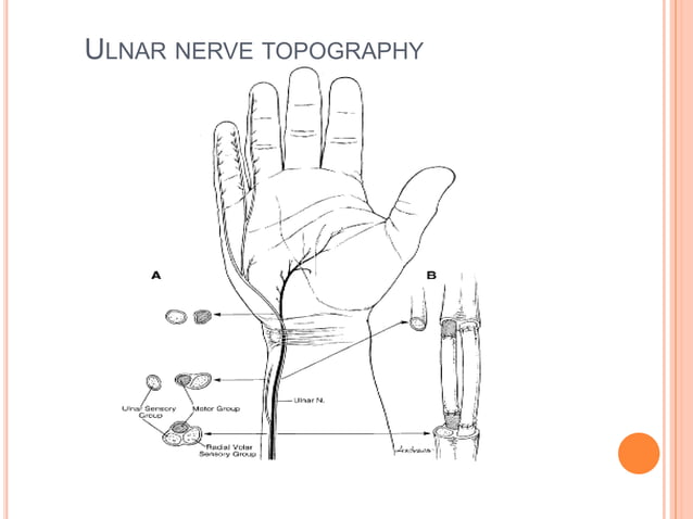 Ulnar nerve seminar
