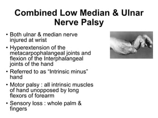 Anatomy and Examination of Ulnar & Sciatic Nerves | PPTX