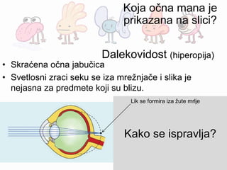 • Skraćena očna jabučica
• Svetlosni zraci seku se iza mrežnjače i slika je
nejasna za predmete koji su blizu.
Konveksno (ispupčeno) sočivo
Kako se ispravlja?
Lik se formira iza žute mrlje
Dalekovidost (hiperopija)
Koja očna mana je
prikazana na slici?
 