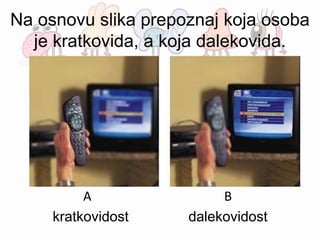 Na osnovu slika prepoznaj koja osoba
je kratkovida, a koja dalekovida.
A B
kratkovidost dalekovidost
 