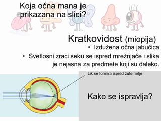 Kratkovidost (miopija)
• Izdužena očna jabučica
• Svetlosni zraci seku se ispred mrežnjače i slika
je nejasna za predmete koji su daleko.
Konkavno (udubljeno) sočivo
Kako se ispravlja?
Lik se formira ispred žute mrlje
Koja očna mana je
prikazana na slici?
 