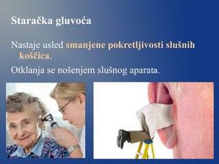 Staračka gluvoća
Nastaje usled smanjene pokretljivosti slušnih
koščica.
Otklanja se nošenjem slušnog aparata.
 