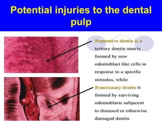 Pulpak Patch UL Pulpal Reactions to Opearative Techniques.pdf