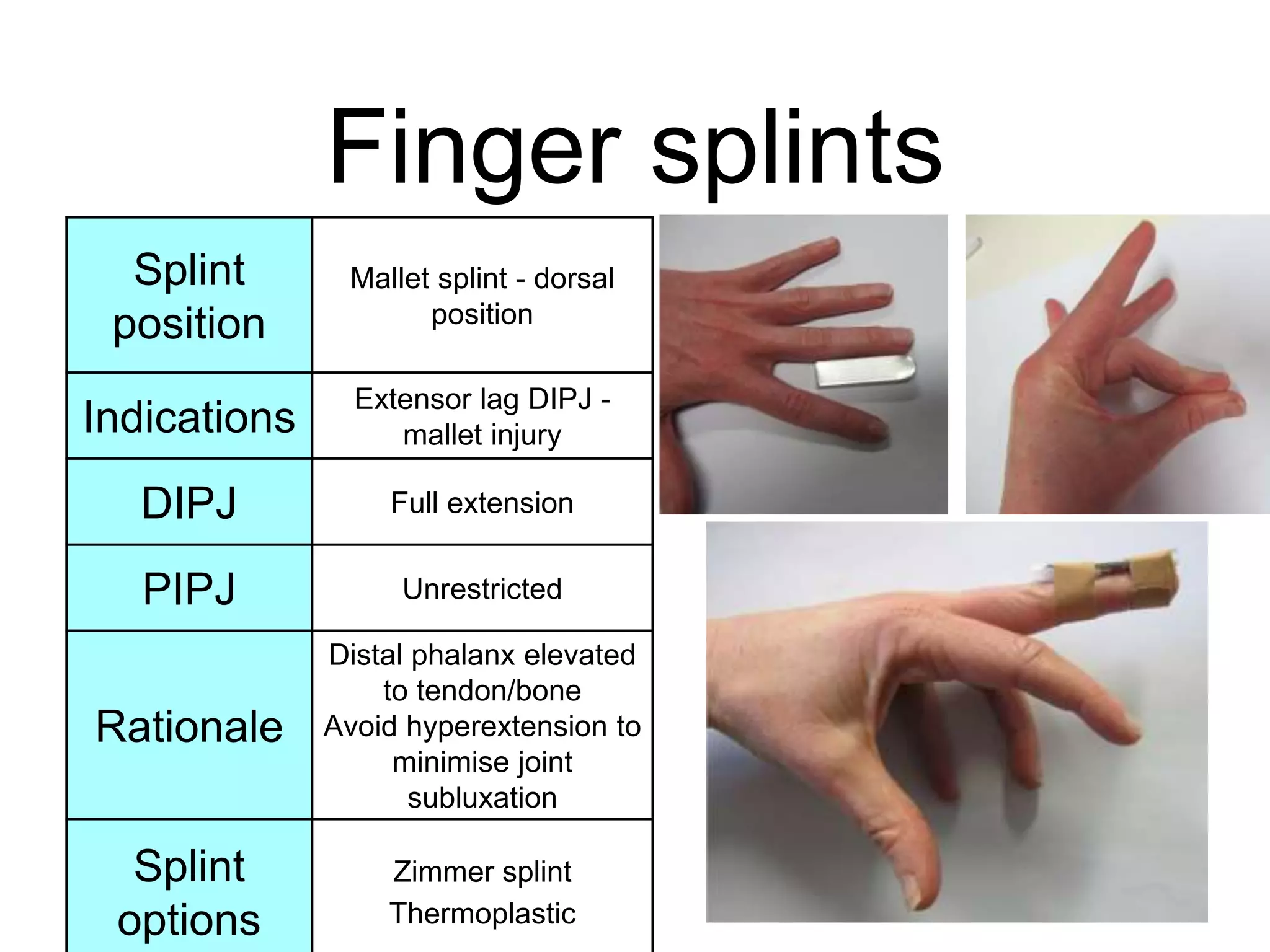 Upper Limb Splinting Workshop PPTX Upper Limb Splinting Workshop PPTX
