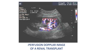 -PERFUSION DOPPLAR IMAGE
OF A RENAL TRANSPLANT
 
