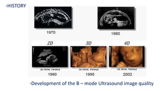 -Development of the B – mode Ultrasound image quality
-HISTORY
 
