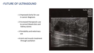--1-Improved clarity for use
in cancer diagnosis
--2-Increased therapeutic use
to correct blood clots and
kidney stones
--3-Portability and veterinary
use
--4-Joint and muscle treatment
through cavitation
-FUTURE OF ULTRASOUND
 