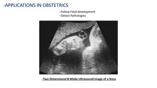 --Follow Fetal development
--Detect Pathologies
-APPLICATIONS IN OBSTETRICS
-Two Dimensional B Mode Ultrasound image of a fetus
 