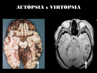 AUTÓPSIA x VIRTÓPSIA
 