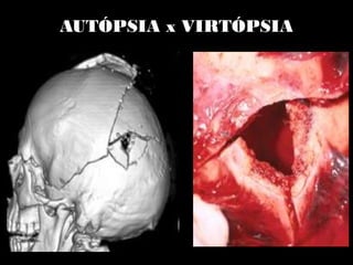 AUTÓPSIA x VIRTÓPSIA
 
