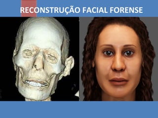 RECONSTRUÇÃO FACIAL FORENSE
 