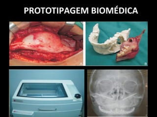PROTOTIPAGEM BIOMÉDICA
 