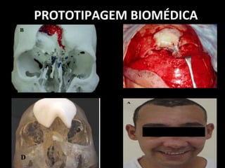 PROTOTIPAGEM BIOMÉDICA
 
