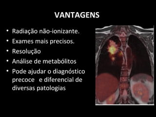 VANTAGENS
• Radiação não-ionizante.
• Exames mais precisos.
• Resolução
• Análise de metabólitos
• Pode ajudar o diagnóstico
precoce e diferencial de
diversas patologias
 