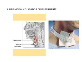 1. DEFINICIÓN Y CUIDADOS DE ENFERMERÍA
 