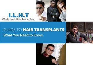 GUIDE TO HAIR TRANSPLANTS
What You Need to Know
 