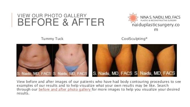 contouring