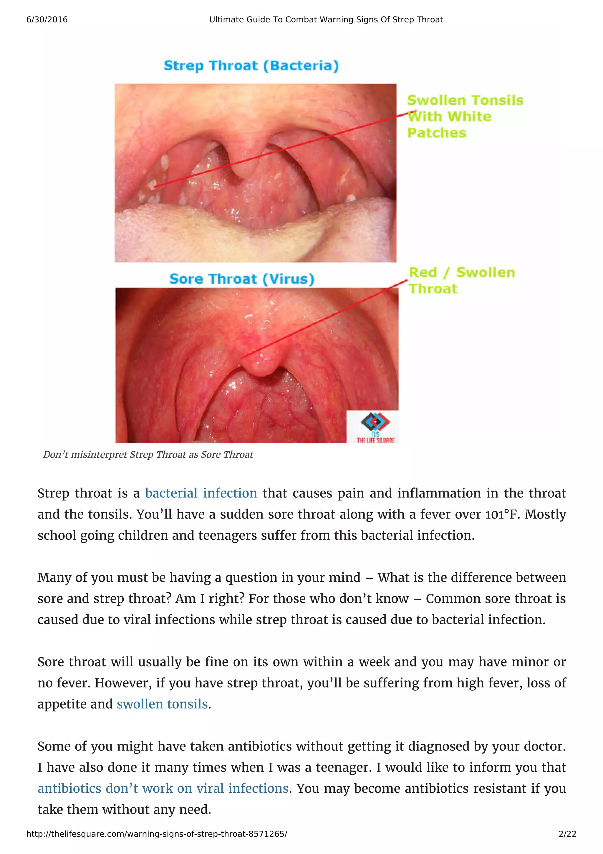 Urgent Warning:  Are You Mistaking Herpes For Strep? - e9orezl