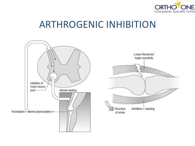 Arthrogenic Muscle Inhibition Pdf