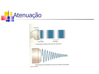 Atenuação 