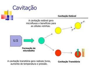 Cavitação Formação de microbolha Cavitação Transitória Cavitação Estável A cavitação transitória gera radicais livres, aumento de temperatura e pressão. A cavitação estável gera microfluxos e benefícios para as células vizinhas.  