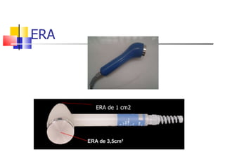 ERA ERA de 1 cm2 